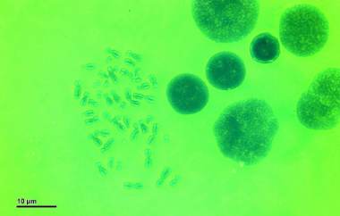 Caryotype humain : les chromosomes, visibles en métaphase de mitose