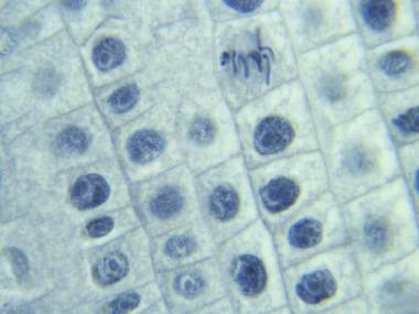 Cellules de racine d'oignon en division : les chromosomes s'alignent au milieu de la cellule